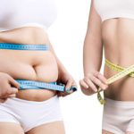 McCarty Weight Loss Center Dallas - Best Weight Loss Surgeon Dallas